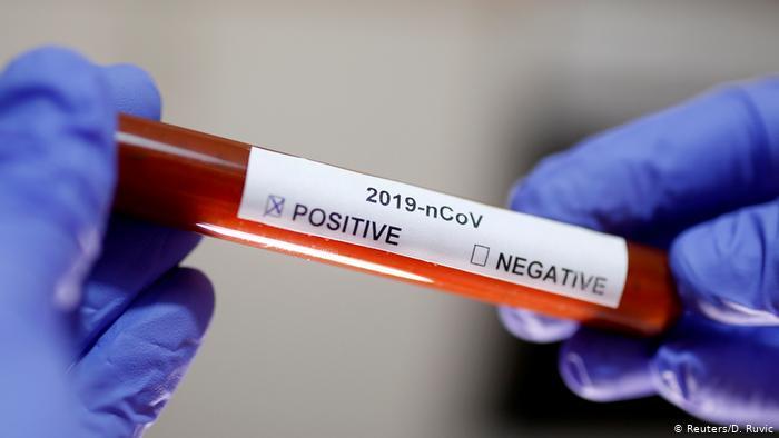 En la Cuarta solo Bragado y Junín tienen casos positivos de coronavirus