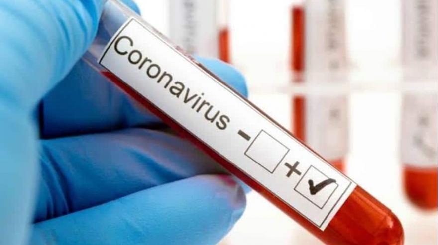 Covid-19: Cuatro nuevos casos y están relacionados al frigorífico