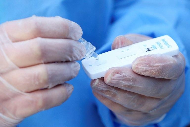 La Provincia prohibió la venta en farmacias de los test rápidos para el coronavirus