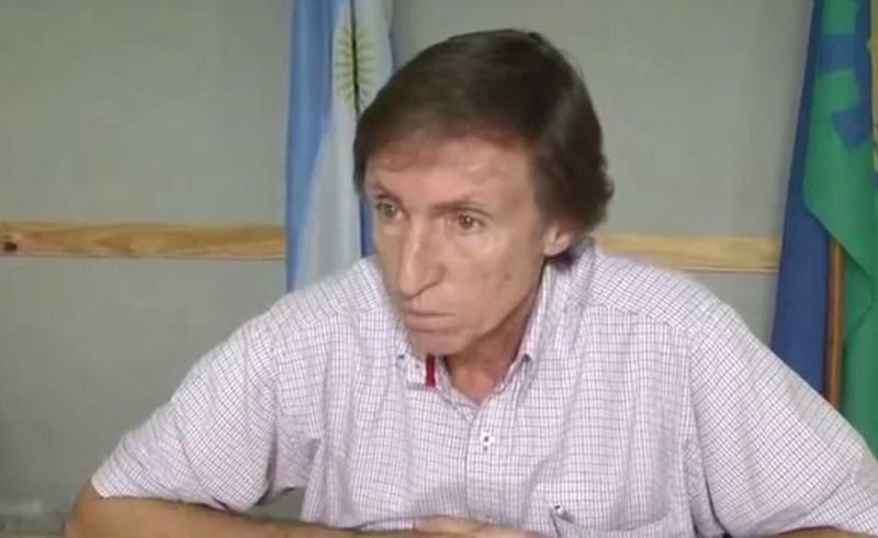 Cabail, sobre el triste presente de la laguna: 