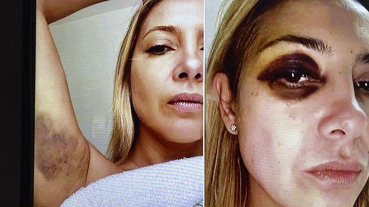 La denuncia de Fabiola a Alberto Fernández: "Hace 3 días que me venís golpeando"