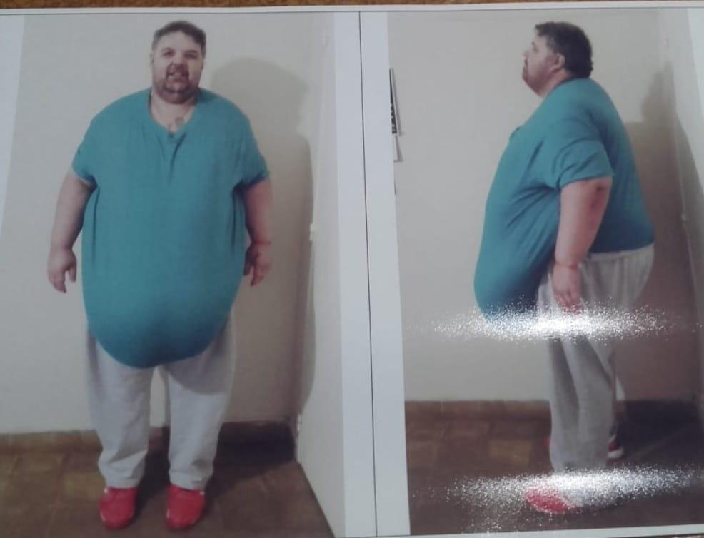 Es de Irala, llegó a pesar 270 kilos y ahora lanza una cruzada para mejorar su salud